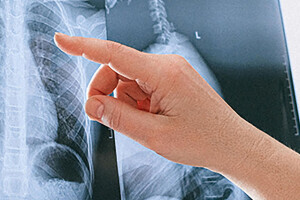 Hand pointing to an x-ray